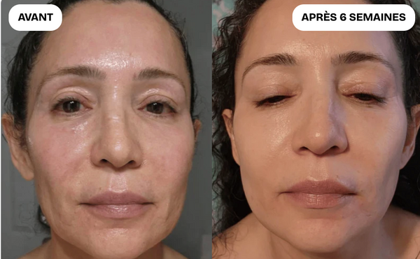 @Sophie, 52 ans